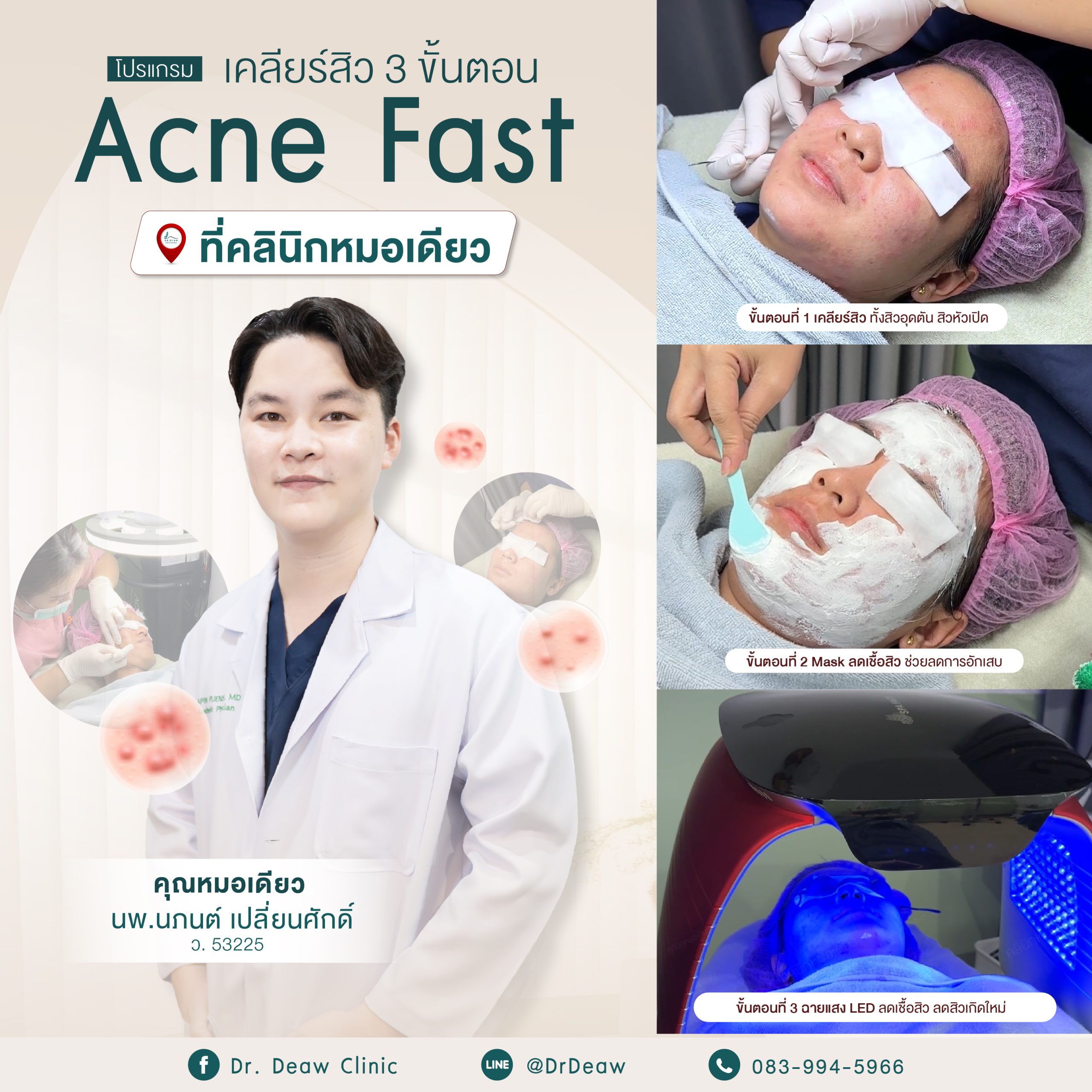 สิว 3 ขั้นตอน