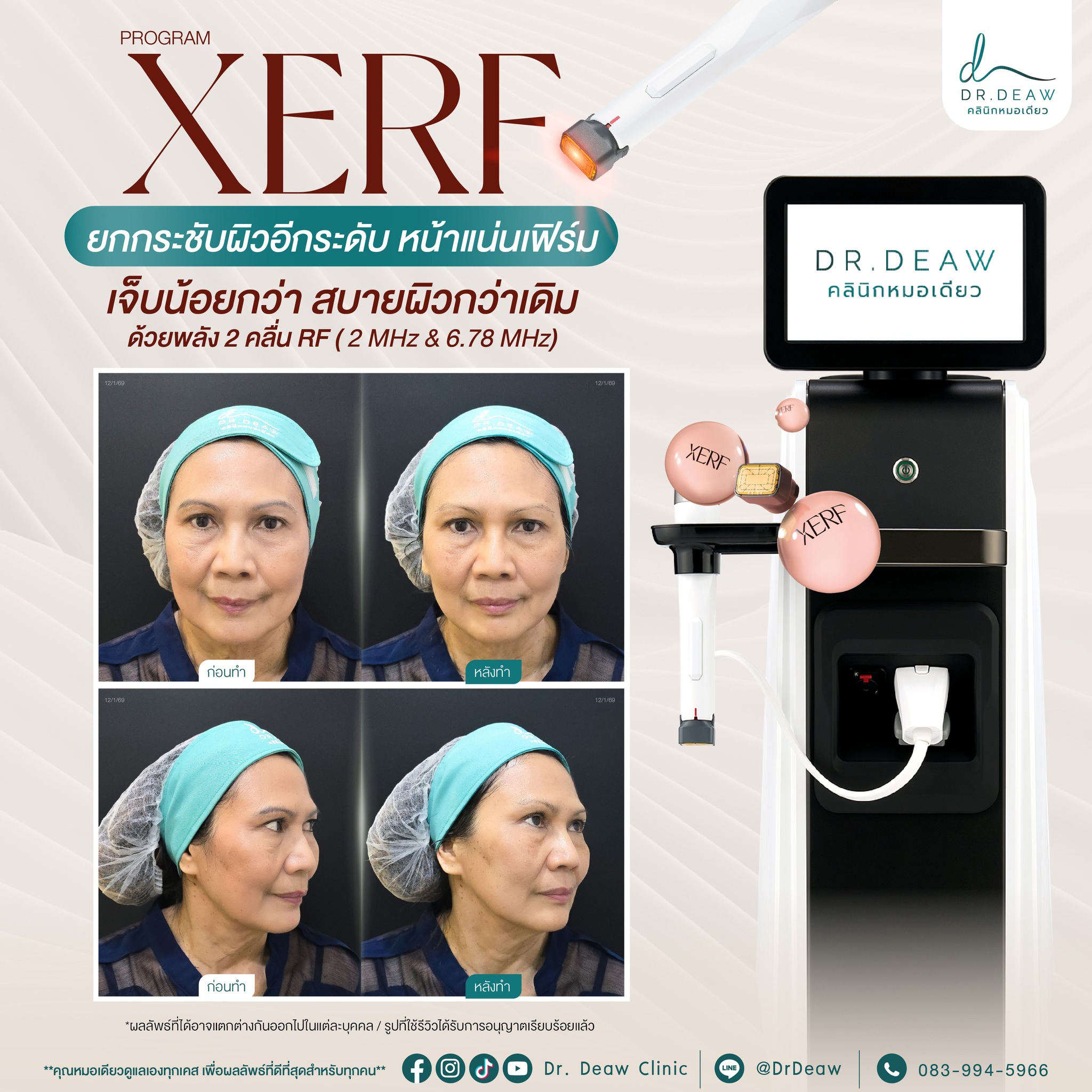 615794830_805436915886759_3350876473963490230_n