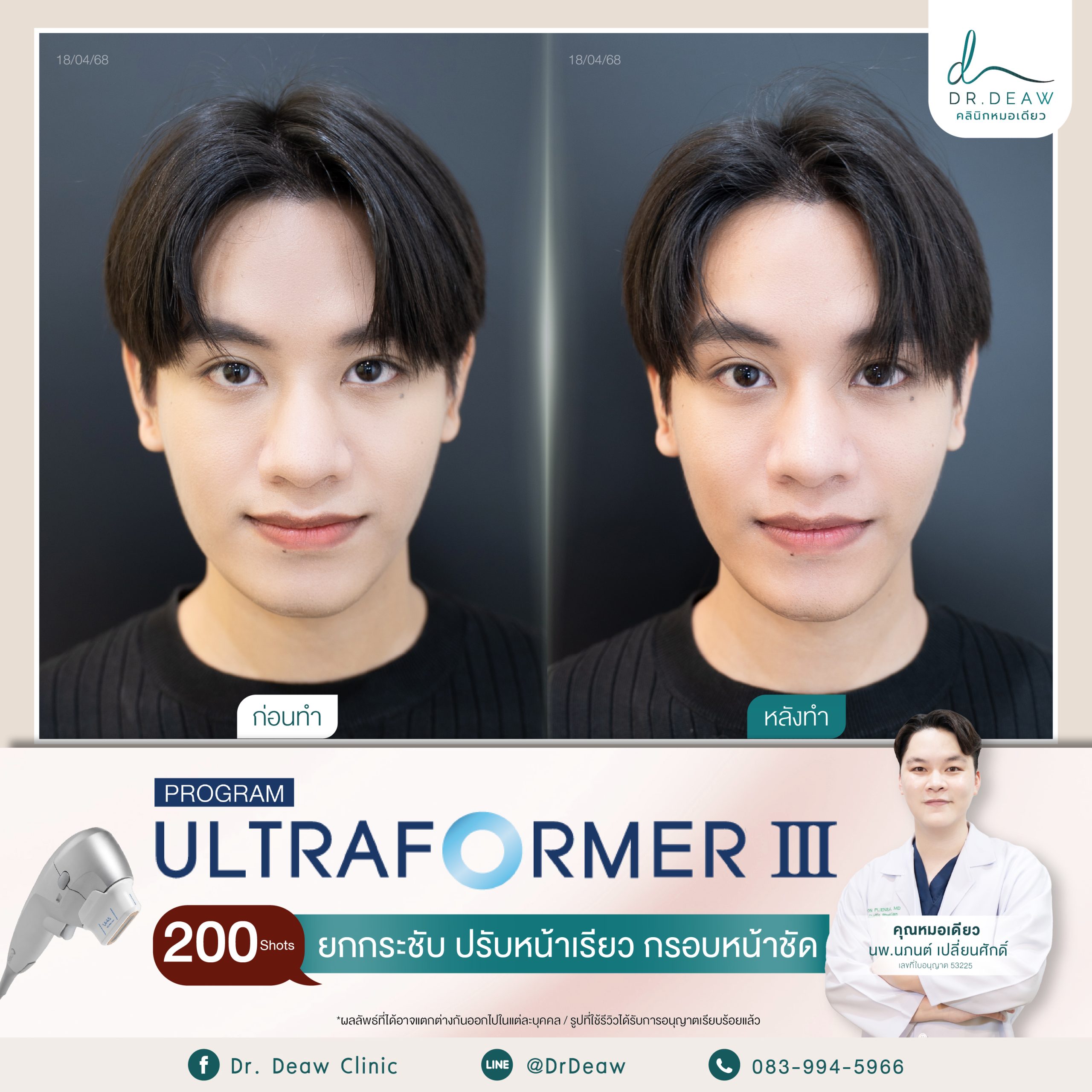 Review UFM 18.4.68.1 (1)