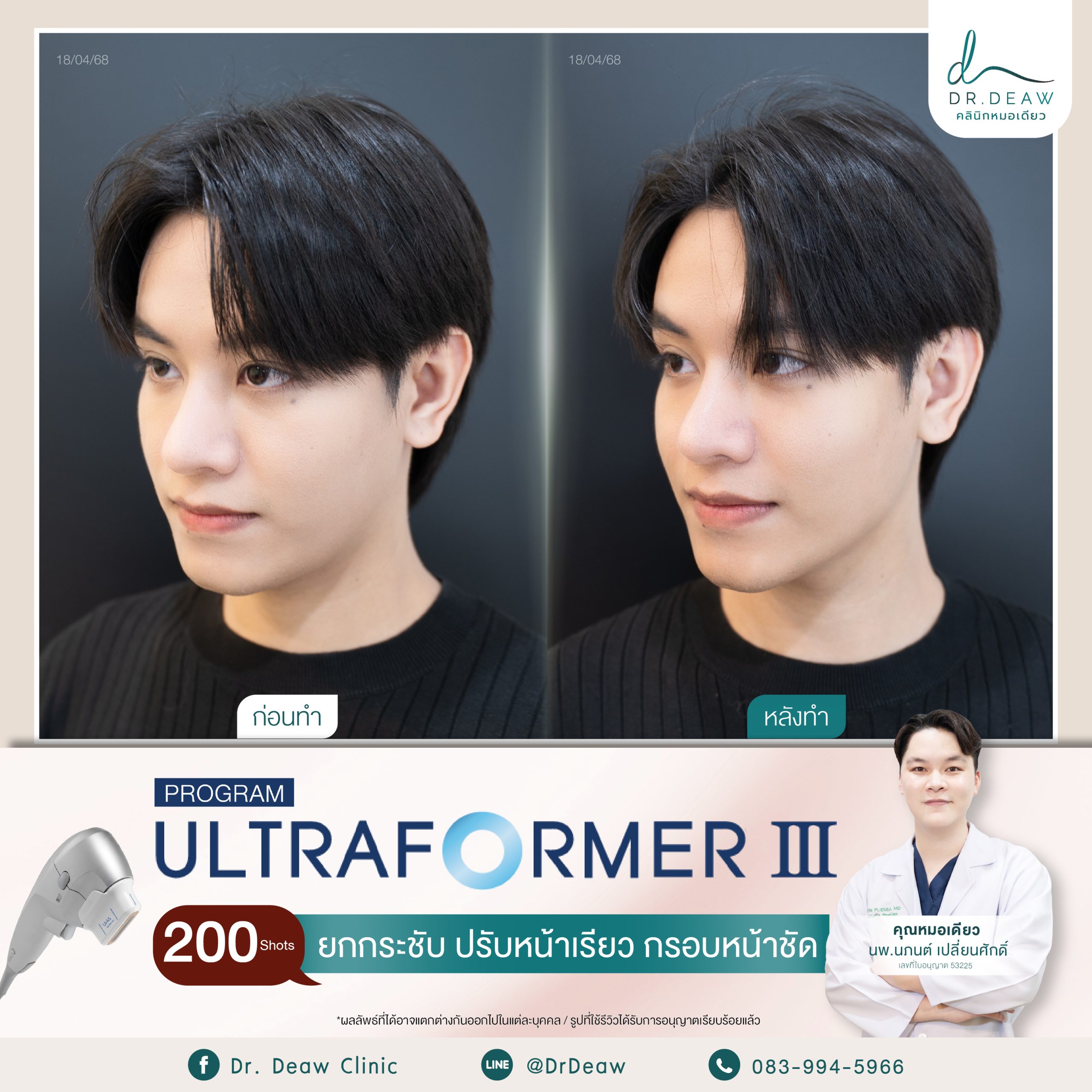 Review UFM 18.4.68.2