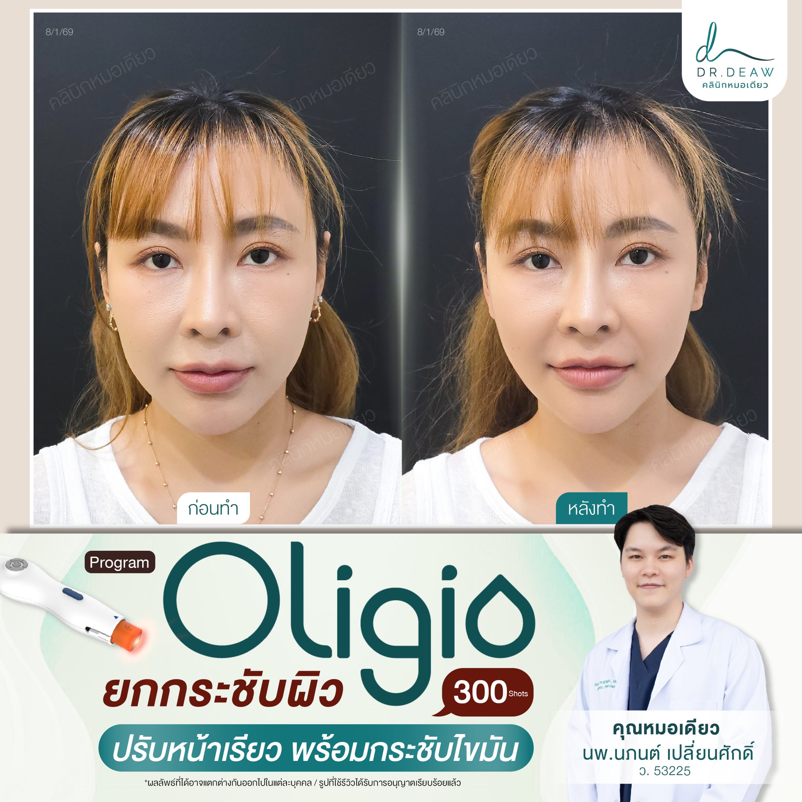 รีวืว Oligio 8.1.69.2_0